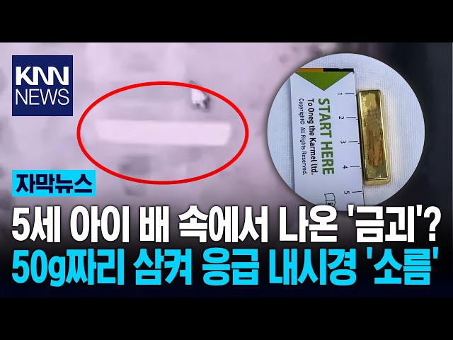 "대체 이걸 어떻게 삼켰지?" 5살 위에서 발견된 '뜻밖의 황금' / KNN