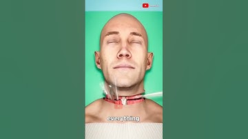 Thumbnail of Full Body Transplant (Explained)#3danimation #doctors #shorts