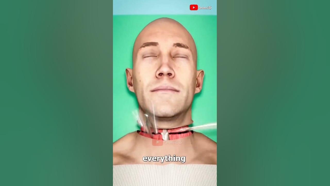 Full Body Transplant (Explained)#3danimation #doctors #shorts