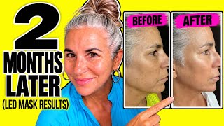 Why Dermatologists Warn Against Some LED Masks (I Tested the New CurrentBody Series 3!)