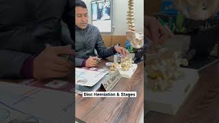 #discherniation #lowbackpain #spine #backpain #scoliosis #kyphosis #bones #spinealignment #back