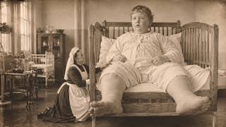 The Last Nurse Who Cared for a Giant Child Born in 1880 — What She Said the Boy Remembered