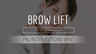 Brow Lift Huntington WV | Best Brow Lift Huntington