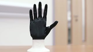 Open Bionics: 3D printed prosthetic limbs - Ultimaker: 3D Printing Story