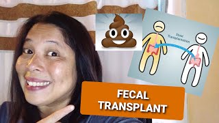 FECAL TRANSPLANT: TREATMENT FOR C. DIFF