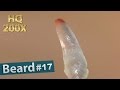 #17 Pull Out Beard, Blackhead and Hair Root(Root Sheath) Close up 200X