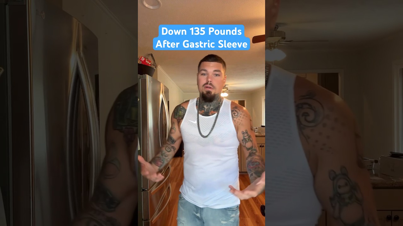 Down 135 lbs After Gastric Sleeve 🎉