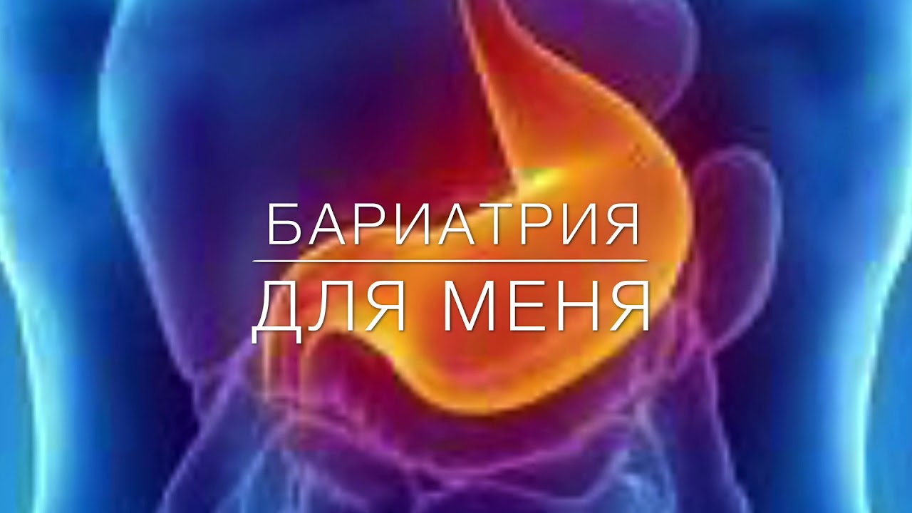 Эффект от ФГДС. БАРИАТРИЯ ДЛЯ МЕНЯ. - YouTube