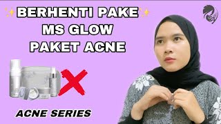Resiko Berhenti Pakai Ms Glow Acne Series