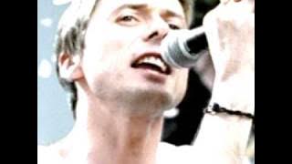 Suede - Positivity