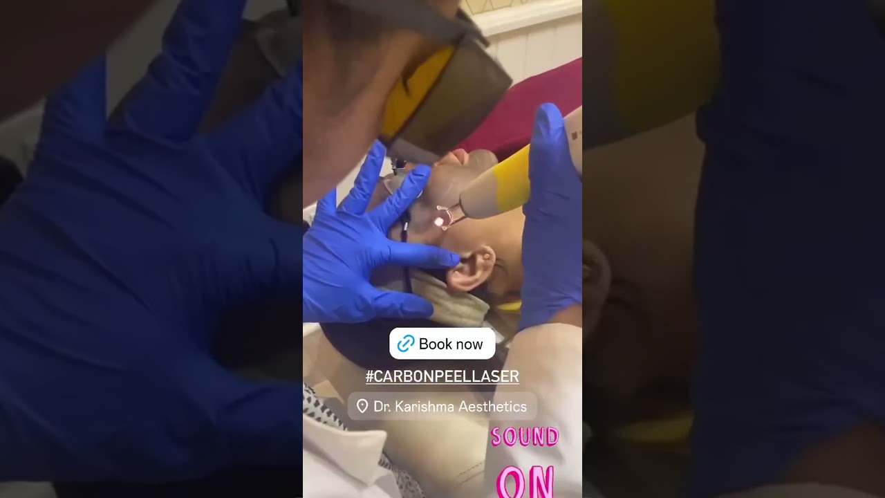 A superficial treatment to help with acne, oily skin, &uneven skin tone. 