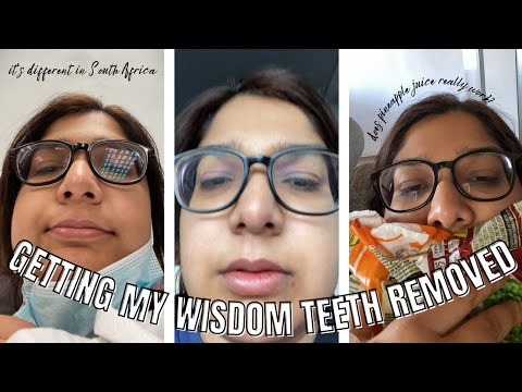 VLOG: I GOT MY WISDOM TEETH REMOVED!!! | DOES PINEAPPLE JUICE ACTUALLY WORK??