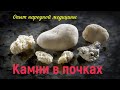 Камни в почках  Как избавится