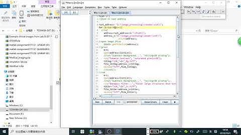 step 2 run the code as plugin in ImageJ to batch process images