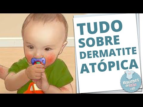 DERMATITE ATÓPICA EM CRIANÇAS - INFLAMAÇÃO NA PELE | MACETES DE MÃE