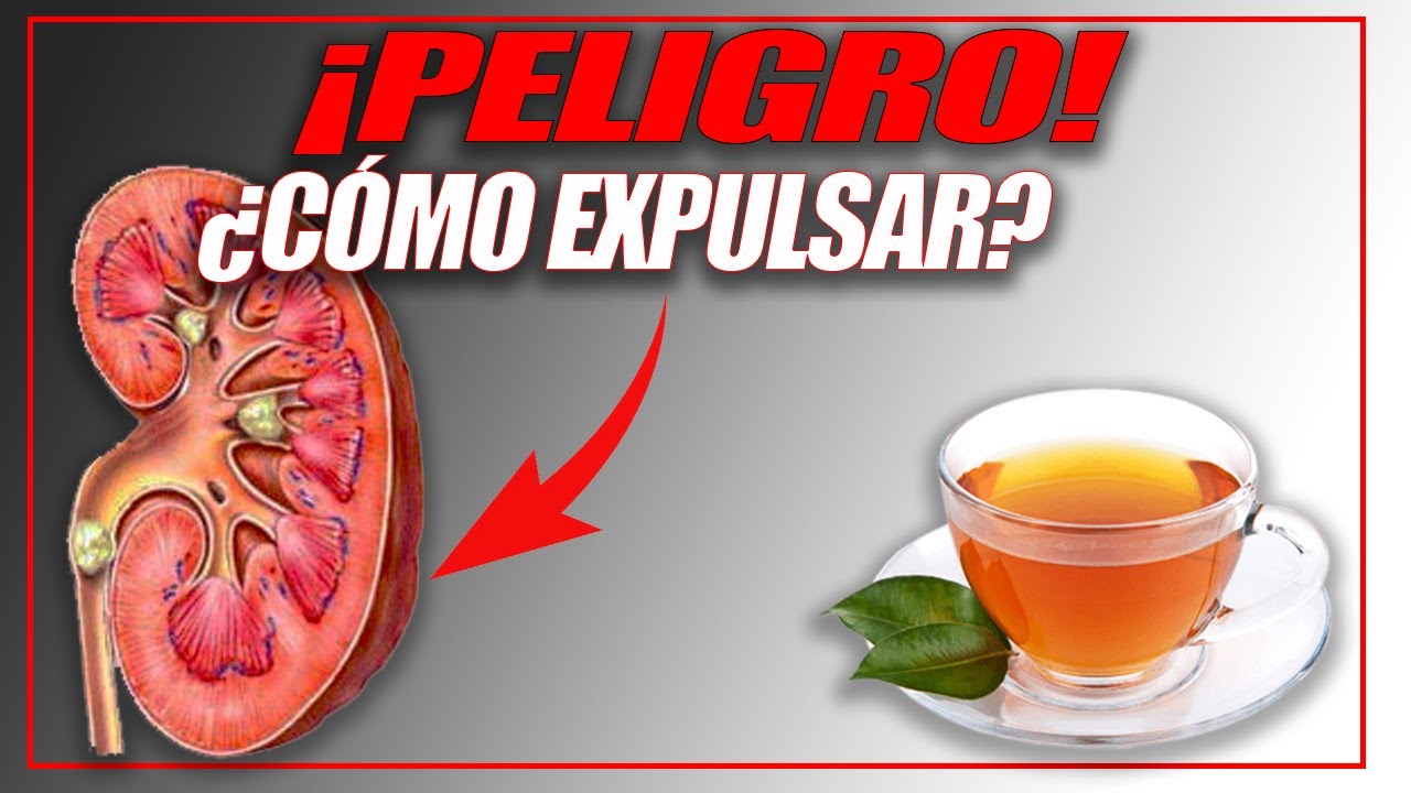 EXPULSA LAS PIEDRAS EN LOS RIÑONES CON ESTE GRAN REMEDIO NATURAL - YouTube