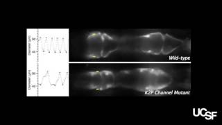 The heart of an aging fruit fly in health and disease