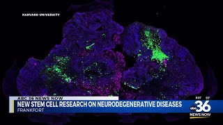 New stem cell research on Neurodegenerative diseases