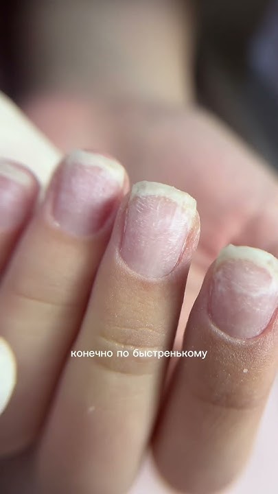 Последняя серия про ГРЫЗУНА. Преображение на 100% #nails #ногти # ...