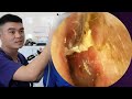 ASMR耳掃除:この音、この映像、もう他の動画に戻れない…🚫