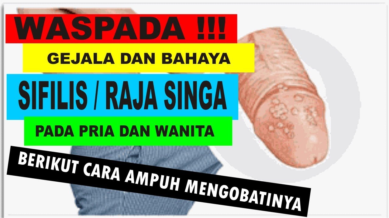 Gejala Penyebab Dan Pengobatan Infeksi Menular Seksual Sifilis (Raja