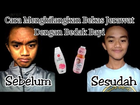 Cara Meluruskan Rambut Dengan Bedak Bayi - Model Rambut
