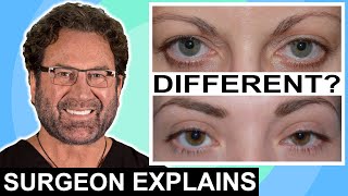 Ptosis Repair vs Blepharoplasty | Surgeon Compares Eyelid Lifts