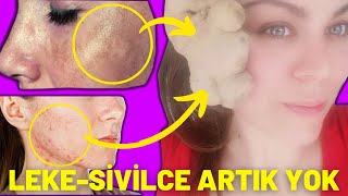 15 DAKİKADA SİVİLCE VE CİLT LEKELERİNİ SİLİP ATAN ZENCEFİL-ZERDEÇAL MASKESİ! DOĞAL CİLT BAKIMI screenshot 1