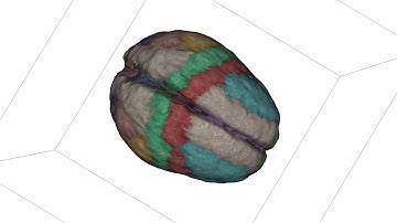 Probabilistic Atlas of the Human Brain