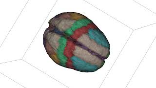 Probabilistic Atlas of the Human Brain