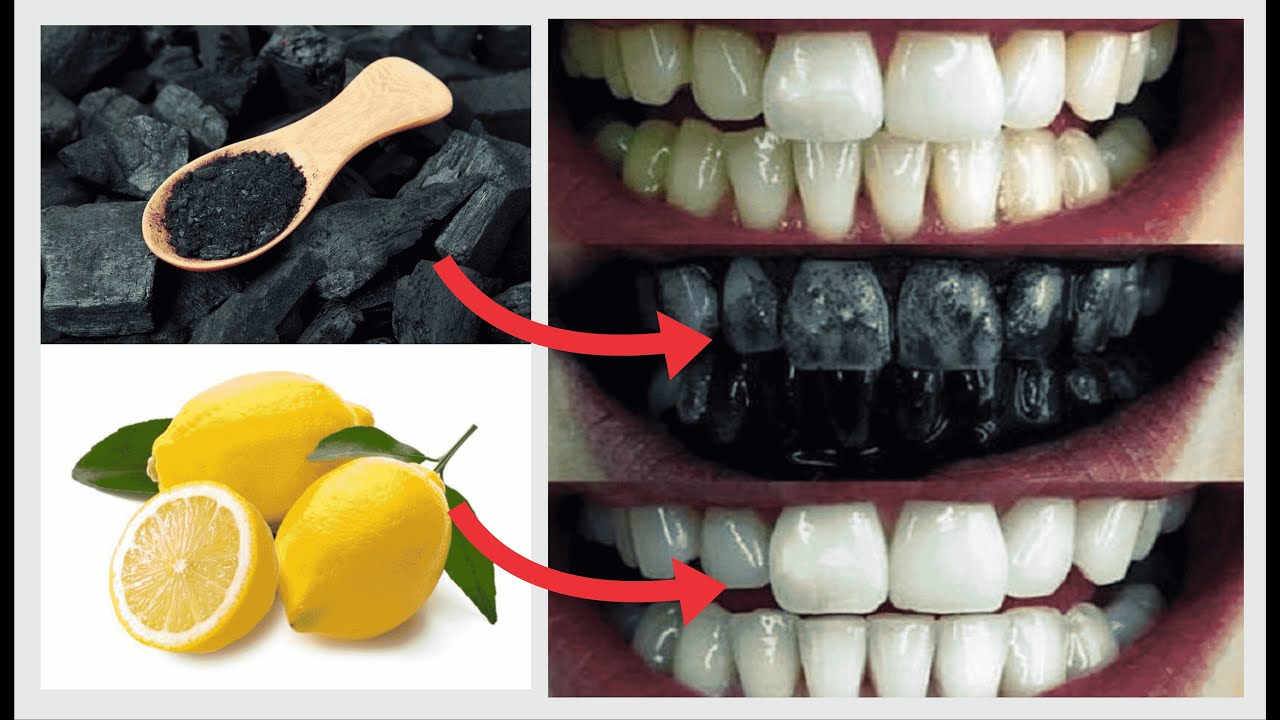 How to whiten teeth naturally at home in just 3 minutes! Your pearly