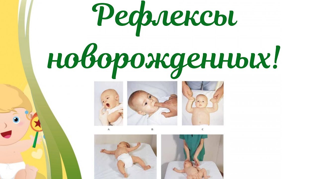Рефлексы в норме. Рефлексы новорожденности. Безусловные рефлексы новорожденного. Физиологические рефлексы новорожденного. Врожденные рефлексы новорожденных.