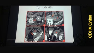 CT Khoang sau phúc mạc Ts. Bs. Hoàng Đình Âu