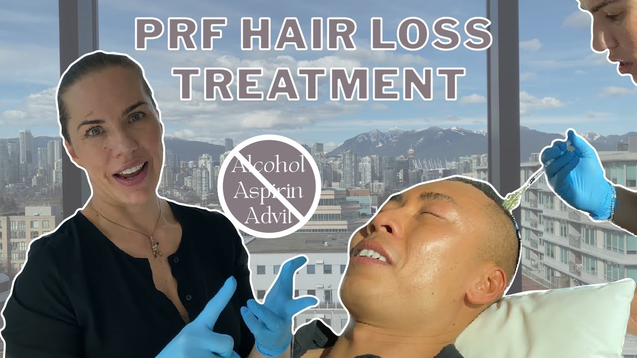 Acupuncturist's First Time Trying Hair Restoration Therapy (PRF