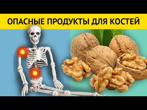 Список самых ОПАСНЫХ и полезных продуктов для КОСТЕЙ + Важные советы по питанию