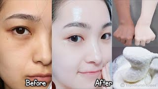 Japanese Secret To Whitening 10 Shades That Removes Wrinkles And Pigmentation For Snow White Skin