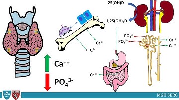 Primary Hyperparathyroidism