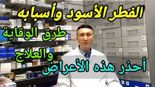 الفطر الأسود: اسباب المرض وعلاقته ب كورونا وطرق الوقاية | دكتور ايمن المسلمى