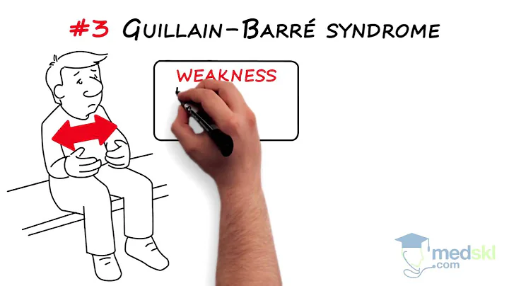 Neurology – Weakness, Paralysis, Paresis and/or Loss of Motion: By Charles Kassardjian M.D. - DayDayNews