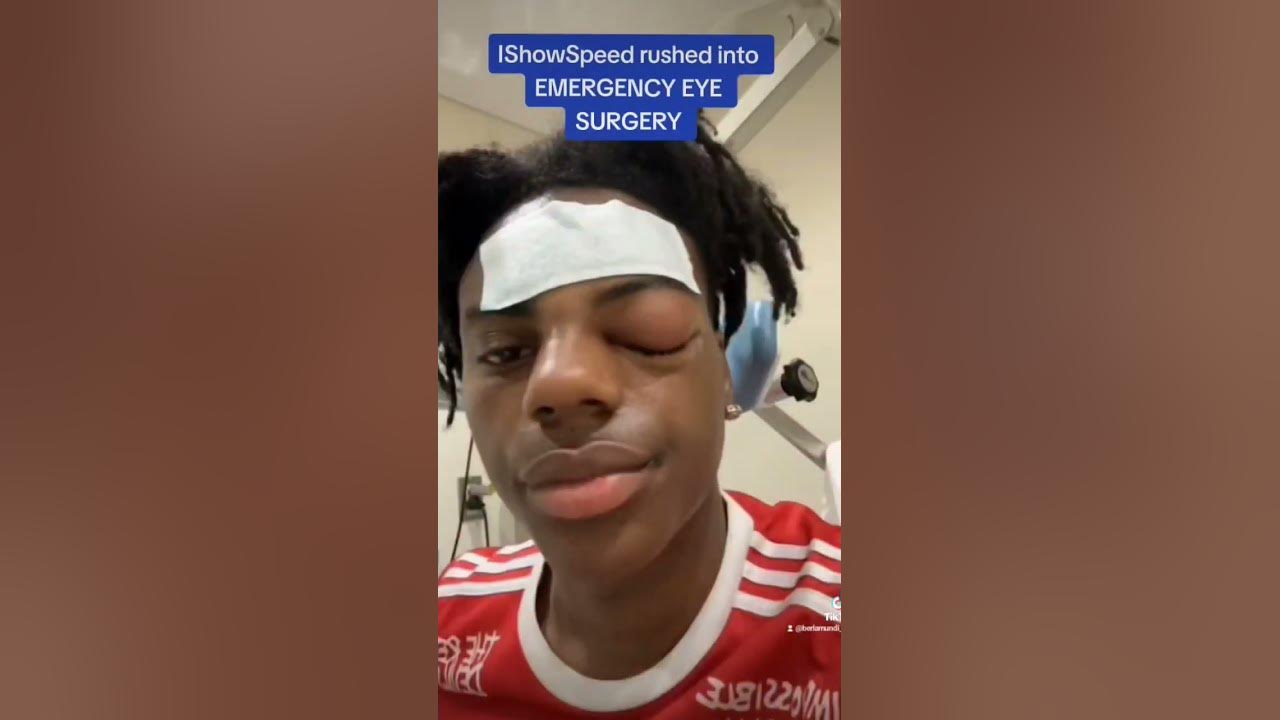 Is IShowSpeed okay? Streamer undergoes emergency surgery in hospital for  swollen eye
