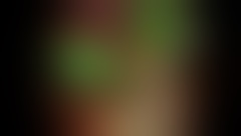 Real Time ICG Laparoscopic Cholecystectomy using Karl Storz Rubina 4K system