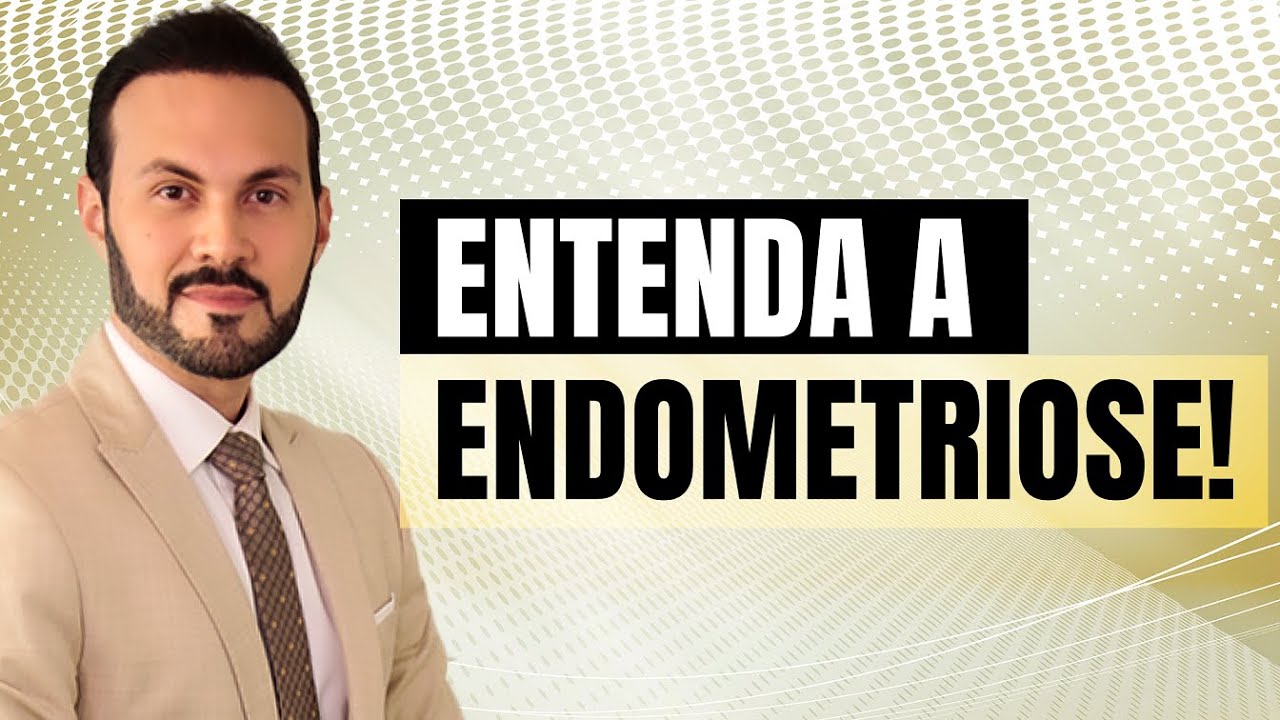 O que é ENDOMETRIOSE: sintomas e como identificar. |  Dr. André Vinícius