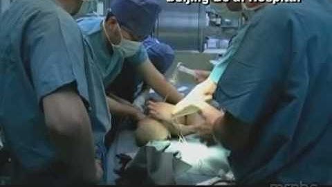 Boy recovering after chopstick removed from brain