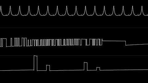 Tao - "STresSTeST" (Atari ST)