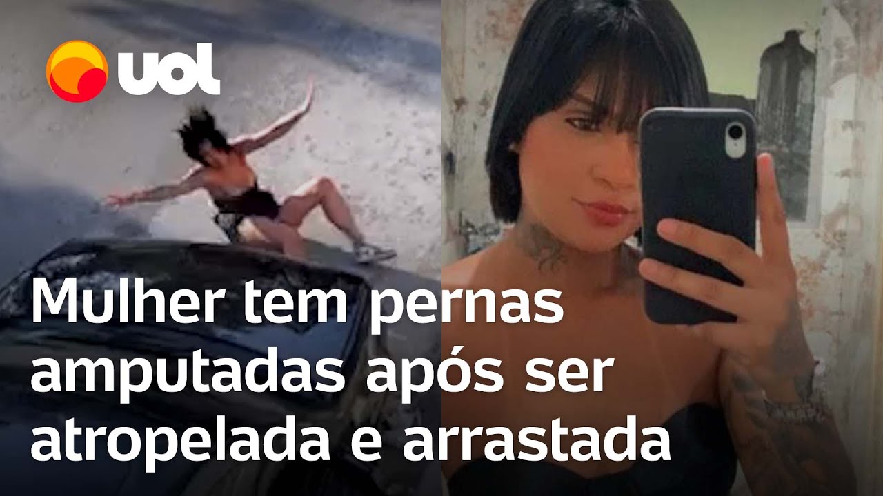 Mulher tem pernas amputadas após ser atropelada e arrastada por homem em SP