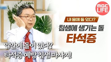 [기분 좋은 날] 레몬 먹고 턱 아프면 