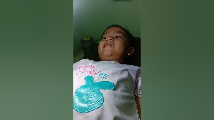 cabut benang jahitan luka di dagu kakak naya..