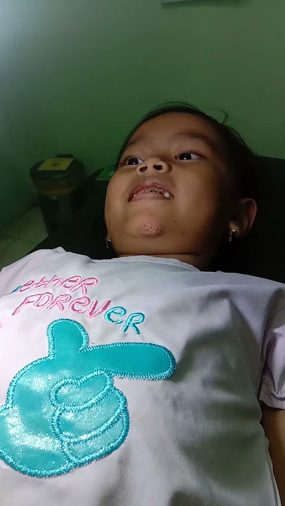 cabut benang jahitan luka di dagu kakak naya..