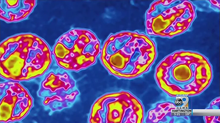 Possible Breakthrough In Fight Against Aids