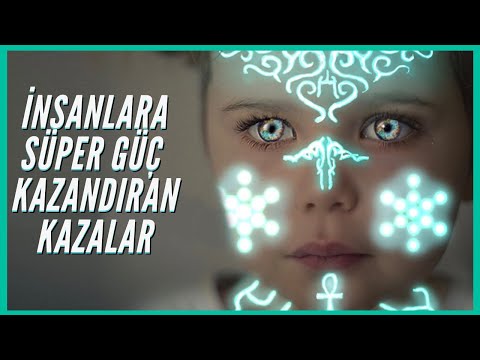 Geçirdikleri Kazadan Sonra Sıra Dışı Yeteneklere Sahip Olan 7 İnsan